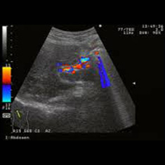 超音波診断 画像