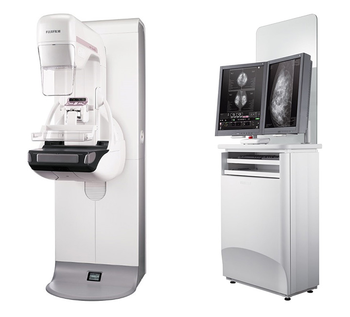 マンモグラフィ検査装置