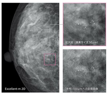 左右の乳房を2方向で撮影します。