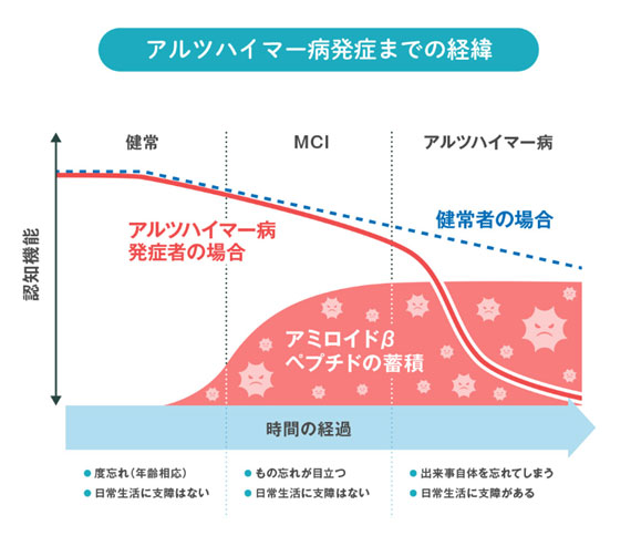 アルツハイマー症発症までの経緯