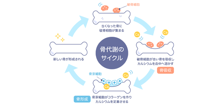 骨粗鬆症とはどんな病気