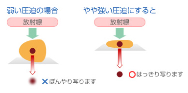 手術（外科治療）