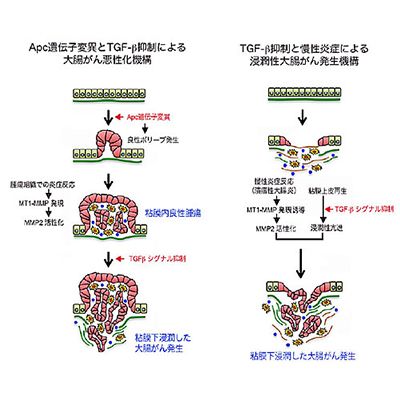 大腸がんの発生過程