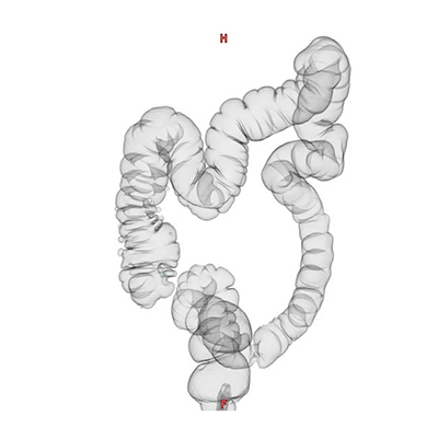 大腸ＣＴ検査（ＣＴ colonography：ＣＴＣ）