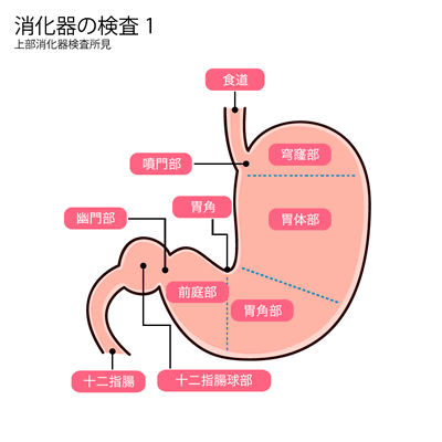 消化器の検査