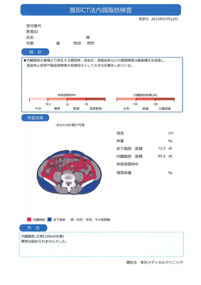 急性期脳梗塞